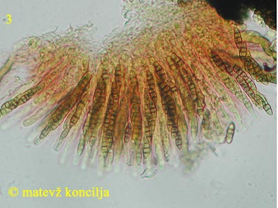 Melanomma fuscidulum - Asci