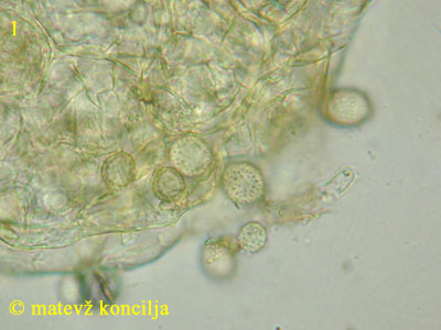 Aspergillus glaucus - konidiji