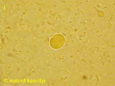 Tremella globispora - en tros