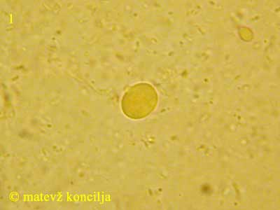 Tremella globispora - en tros