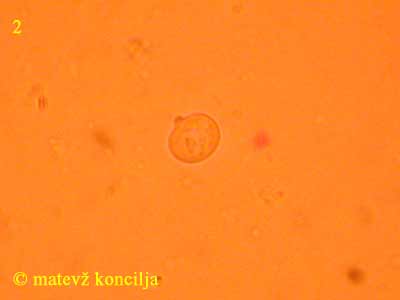 Tremella globispora - Spore