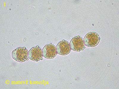 Puccinia graminis - Aeziosporen