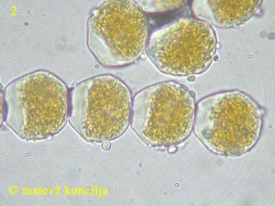 Puccinia graminis - Aeziosporen