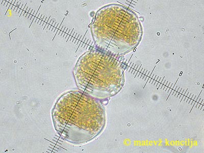 Puccinia graminis - Aeziosporen