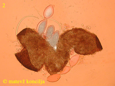 Blumeria graminis - Asci