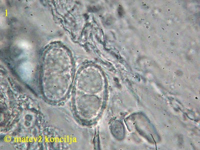 Humaria hemisphaerica - trosi