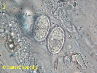 Humaria hemisphaerica - trosi