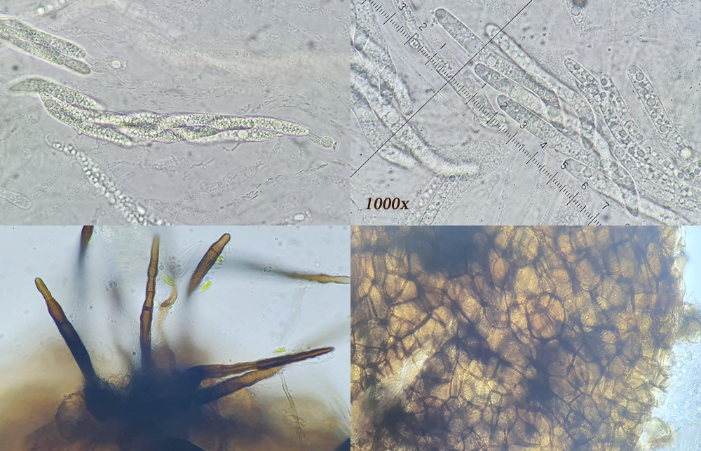 Lasiosphaeris hirsuta s.l.