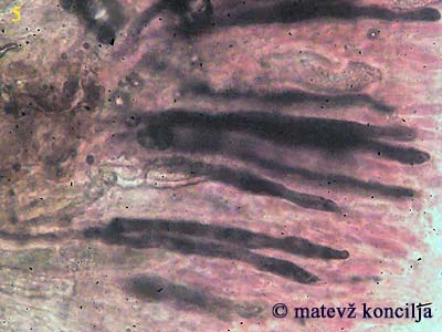 Peniophora incarnata - Gloeozystiden