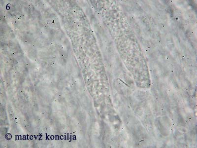 Peniophora incarnata - Gloeozystiden