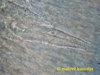 Peniophora incarnata - Lamprozystiden
