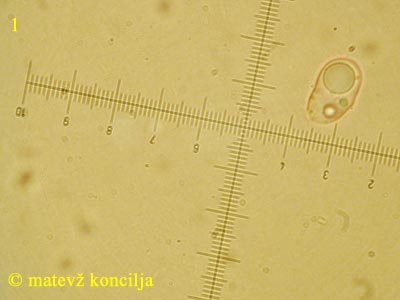 Sebacina incrustans - Spore