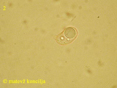 Sebacina incrustans - Spore