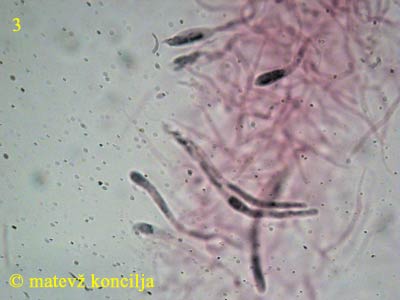 Russula integra - Pileozystiden