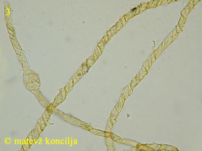 Trichia contorta var. iowensis - capillitium