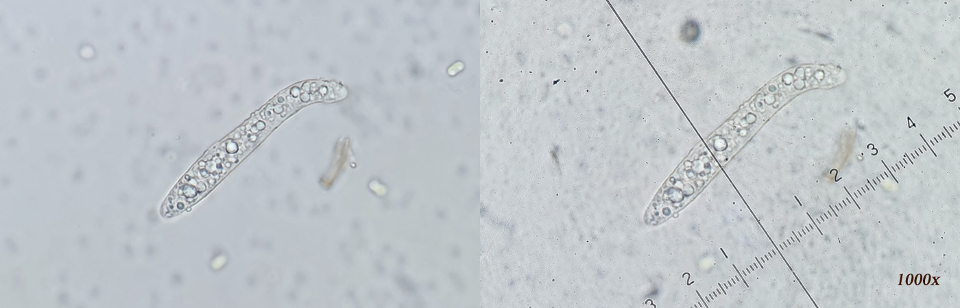 Lasiosphaeris hirsuta