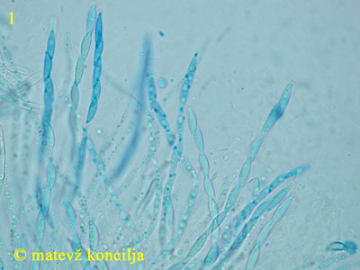 Hypomyces lateritius - Asci