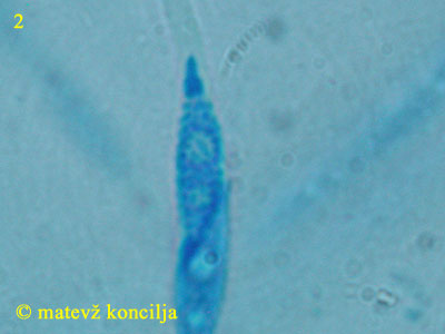 Hypomyces lateritius - Ascosporen