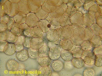 Leocarpus fragilis - Sporen