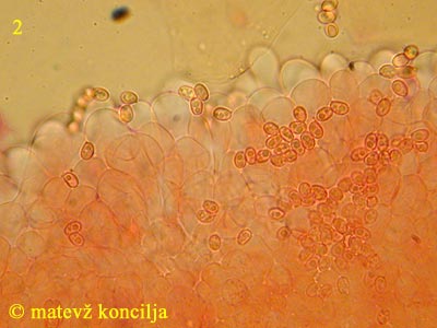 Lepiota lilacea - cistide in trosi