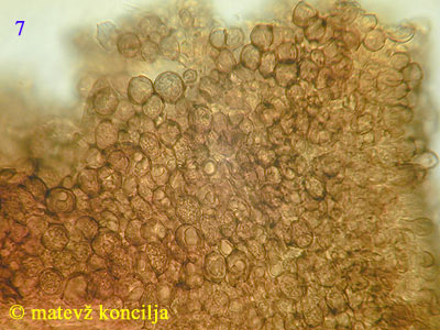 Mollisia lividofusca - Excipulum