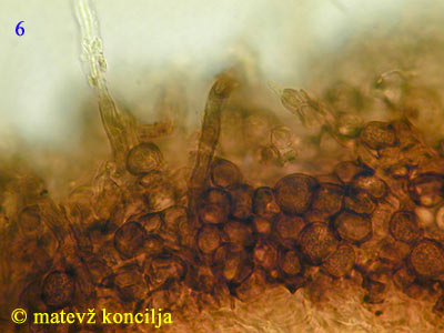 Mollisia lividofusca - Hyphen