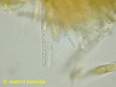 Mollisia lividofusca - Paraphyse