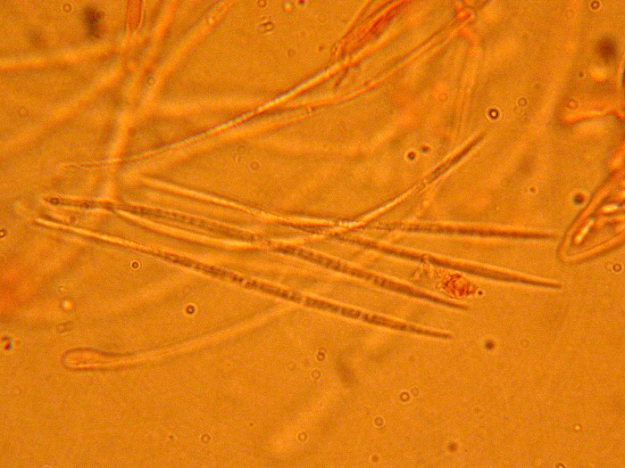 Lophodermium piceae - Fichtennadel-Spaltlippe