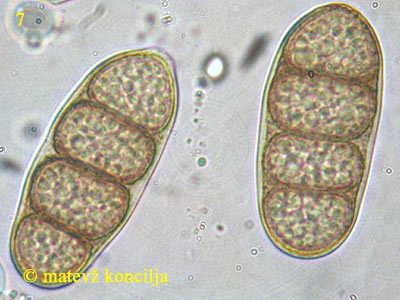 Macrodiplodiopsis desmazieresii