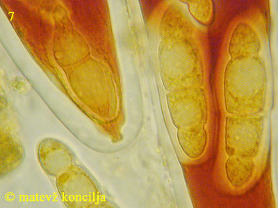 asteromassaria macrospora - apikalni aparat