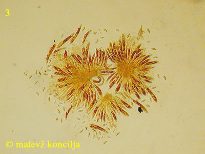 Asteromassaria macrospora - Asci