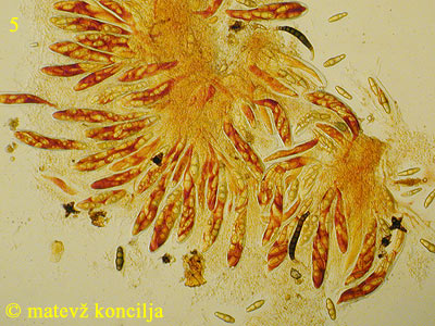 Asteromassaria macrospora - Asci