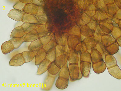 Puccinia magnusiana - Teliosporen