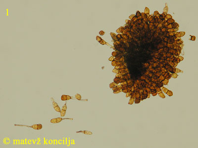 Puccinia magnusiana - Teliosporen