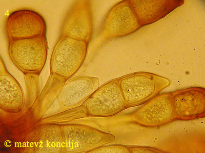 Puccinia magnusiana - Teliosporen