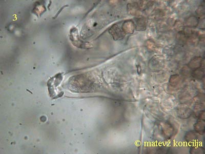 inocybe-margaritispora-kajlocistide