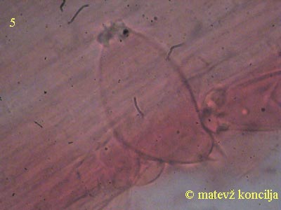inocybe-margaritispora-kaulocistide
