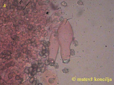 inocybe-margaritispora-kajlocistide
