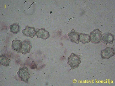 inocybe-margaritispora-trosi