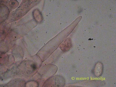 Melanoleuca cognata - Cheilozystide