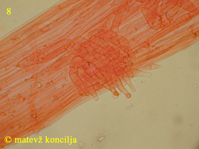 Psathyrella microrhiza - kavlocistide