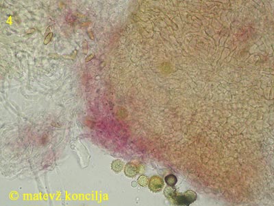 hypomyces microspermus - peritecij