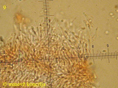 Hyalopeziza millepunctata - konidiji