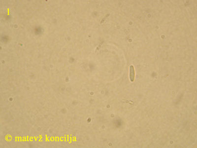 Hyalopeziza millepunctata - tros