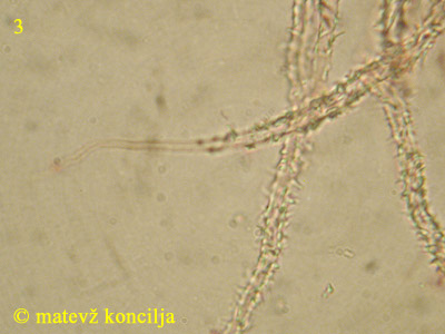 Flagelloscypha minutissima - Haare
