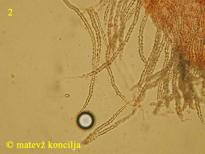 Flagelloscypha minutissima - Haare