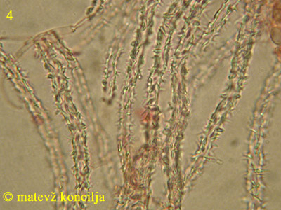 Flagelloscypha minutissima - Haare