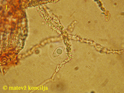 Flagelloscypha minutissima - Spore