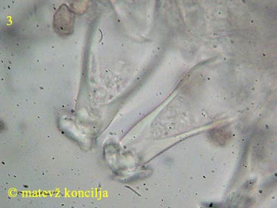 inocybe mixtilis - kajlocistide