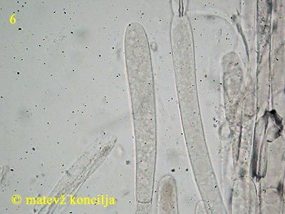 volvariella murinella - epicutis